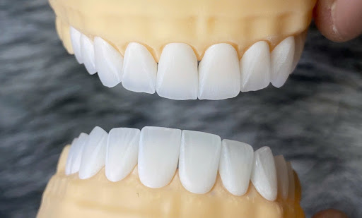 Labo răng sứ là gì? Vai trò quan trọng trong nha khoa thẩm mỹ