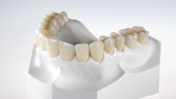 Labo răng sứ làm zirconia với công nghệ cao, độ chính xác tuyệt đối